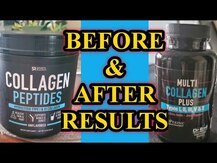 Vital Vitamins, Коллаген, Multi Collagen Complex, 150 капсул